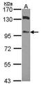 Mitogen-Activated Protein Kinase Kinase Kinase 20 antibody, PA5-27881, Invitrogen Antibodies, Western Blot image 