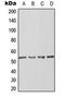 Actin Like 6A antibody, MBS8239389, MyBioSource, Western Blot image 