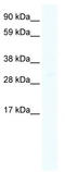 Homeobox C6 antibody, TA330142, Origene, Western Blot image 