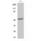 Ribosomal Protein S6 Kinase B2 antibody, LS-C385320, Lifespan Biosciences, Western Blot image 