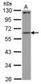 Cytoplasmic Polyadenylation Element Binding Protein 1 antibody, NBP2-15982, Novus Biologicals, Western Blot image 