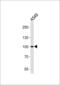 Zinc Finger Protein 287 antibody, PA5-35209, Invitrogen Antibodies, Western Blot image 