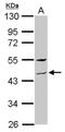 Zinc Finger Protein 514 antibody, NBP2-21022, Novus Biologicals, Western Blot image 
