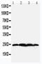 BCL2 Associated Athanogene 2 antibody, LS-C313217, Lifespan Biosciences, Western Blot image 