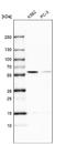 Ro60, Y RNA Binding Protein antibody, NBP2-55127, Novus Biologicals, Western Blot image 