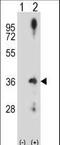 Cyclin D2 antibody, LS-B10672, Lifespan Biosciences, Western Blot image 
