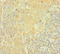 AKT Serine/Threonine Kinase 2 antibody, CSB-PA15919A0Rb, Cusabio, Immunohistochemistry paraffin image 