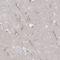 Centrosomal Protein 170B antibody, NBP2-31739, Novus Biologicals, Immunohistochemistry paraffin image 