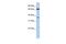 ATP Binding Cassette Subfamily B Member 9 antibody, PA5-42403, Invitrogen Antibodies, Western Blot image 