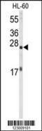 Eukaryotic Translation Initiation Factor 4E antibody, 60-601, ProSci, Western Blot image 