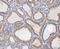 Fission, Mitochondrial 1 antibody, A01932-3, Boster Biological Technology, Immunohistochemistry paraffin image 