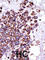 Calcium/Calmodulin Dependent Protein Kinase I antibody, abx033231, Abbexa, Western Blot image 