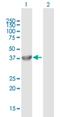 F-Box And Leucine Rich Repeat Protein 8 antibody, H00055336-B01P, Novus Biologicals, Western Blot image 