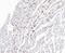 EWS RNA Binding Protein 1 antibody, NBP2-80458, Novus Biologicals, Immunohistochemistry paraffin image 