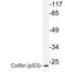 CFL1 antibody, LS-C177996, Lifespan Biosciences, Western Blot image 