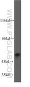 Protein Tyrosine Phosphatase Non-Receptor Type 1 antibody, 11334-1-AP, Proteintech Group, Western Blot image 