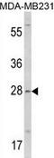 Collectin Subfamily Member 11 antibody, GTX81694, GeneTex, Western Blot image 