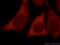 Matrix Metallopeptidase 1 antibody, 10371-2-AP, Proteintech Group, Immunofluorescence image 