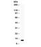 C-C Motif Chemokine Ligand 11 antibody, R32127, NSJ Bioreagents, Western Blot image 