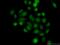 Methyltransferase Like 4 antibody, 17718-1-AP, Proteintech Group, Immunofluorescence image 