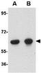 OTU Deubiquitinase 5 antibody, GTX31361, GeneTex, Western Blot image 