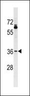 Olfactory Receptor Family 51 Subfamily T Member 1 antibody, LS-C158483, Lifespan Biosciences, Western Blot image 