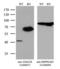 Alpha-Methylacyl-CoA Racemase antibody, LS-C791659, Lifespan Biosciences, Western Blot image 