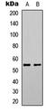 Serum/Glucocorticoid Regulated Kinase 1 antibody, LS-C358860, Lifespan Biosciences, Western Blot image 