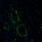 Inositol-Trisphosphate 3-Kinase A antibody, PA5-59185, Invitrogen Antibodies, Immunofluorescence image 
