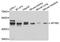 Adaptor Related Protein Complex 1 Subunit Mu 2 antibody, A8331, ABclonal Technology, Western Blot image 