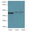 Stromal Cell Derived Factor 4 antibody, LS-C379270, Lifespan Biosciences, Western Blot image 