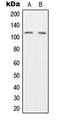 Hepatocyte Growth Factor-Regulated Tyrosine Kinase Substrate antibody, MBS8216713, MyBioSource, Western Blot image 