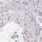 Cyclase Associated Actin Cytoskeleton Regulatory Protein 2 antibody, PA5-62932, Invitrogen Antibodies, Immunohistochemistry paraffin image 