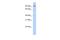 Tetratricopeptide Repeat Domain 14 antibody, A14112, Boster Biological Technology, Western Blot image 