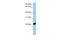 Coagulation Factor X antibody, 25-720, ProSci, Western Blot image 