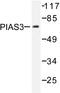 Protein Inhibitor Of Activated STAT 3 antibody, AP06454PU-N, Origene, Western Blot image 