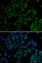 Tryptophan Hydroxylase 2 antibody, A01643, Boster Biological Technology, Western Blot image 