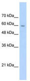 Solute Carrier Family 22 Member 1 antibody, TA346097, Origene, Western Blot image 