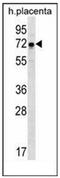 Glucosamine (UDP-N-Acetyl)-2-Epimerase/N-Acetylmannosamine Kinase antibody, AP51881PU-N, Origene, Western Blot image 