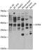 Somatostatin Receptor 4 antibody, 22-610, ProSci, Western Blot image 