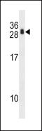 Regulator Of Calcineurin 1 antibody, MBS9215143, MyBioSource, Western Blot image 