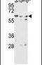 Glucosamine (N-Acetyl)-6-Sulfatase antibody, PA5-13516, Invitrogen Antibodies, Western Blot image 
