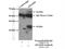 ADAM Metallopeptidase Domain 28 antibody, 22234-1-AP, Proteintech Group, Immunoprecipitation image 