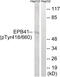 Erythrocyte Membrane Protein Band 4.1 antibody, 79-909, ProSci, Western Blot image 
