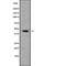 Mitochondrial Ribosome Associated GTPase 2 antibody, abx215766, Abbexa, Western Blot image 