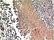 Phosphatase And Tensin Homolog antibody, GTX34151, GeneTex, Immunohistochemistry paraffin image 