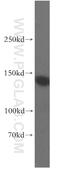 SLIT-ROBO Rho GTPase Activating Protein 3 antibody, 12823-1-AP, Proteintech Group, Western Blot image 