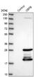 Core-Binding Factor Subunit Beta antibody, NBP1-87300, Novus Biologicals, Western Blot image 