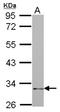 Natural Cytotoxicity Triggering Receptor 1 antibody, NBP2-19496, Novus Biologicals, Western Blot image 