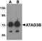 ATPase Family AAA Domain Containing 3B antibody, NBP1-76587, Novus Biologicals, Western Blot image 